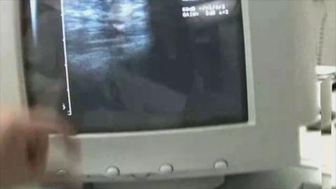 22146
